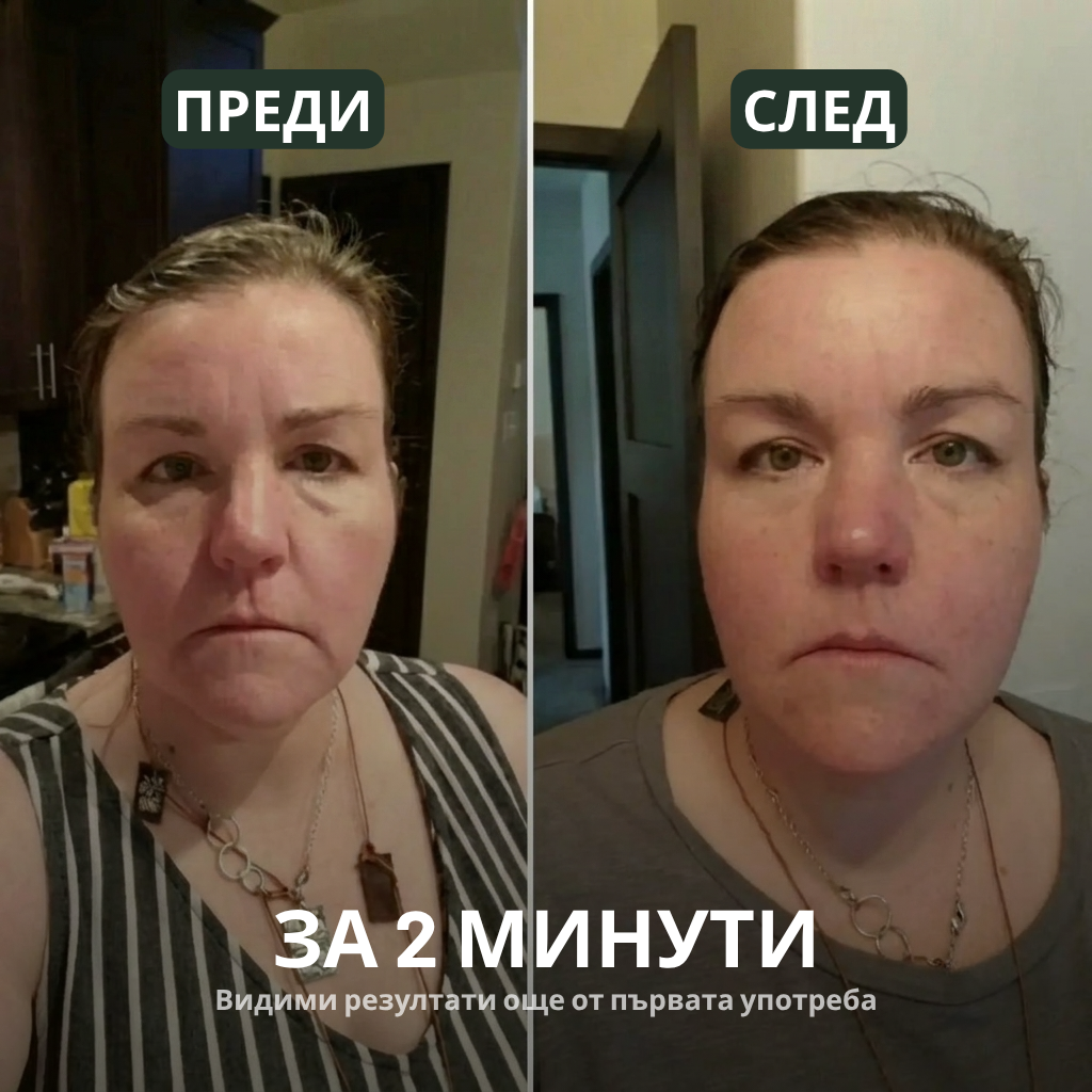 Veldonia | Четка за лимфен масаж на лице